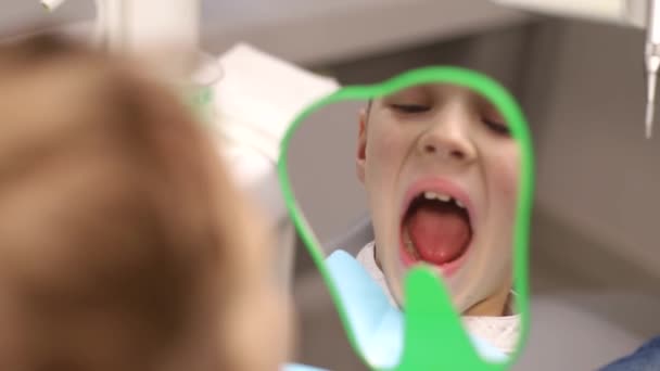 Odontologia. O dentista examina os dentes de leite. Close-up, atendimento odontológico para crianças, o conceito de uma boca saudável. — Vídeo de Stock