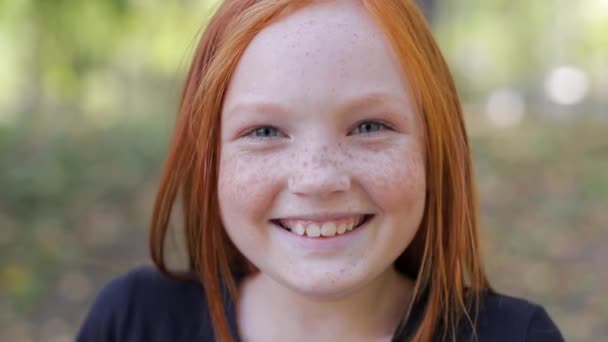Natural appearance of a girl with beautiful freckles on her face. — Vídeo de stock