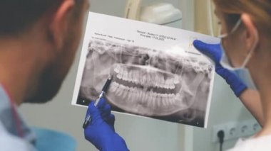 Kadın doktor hastaya diş röntgenini gösterir. Dişçi müşteriyle modern bir diş kliniğinde iletişim kurar. 4k video