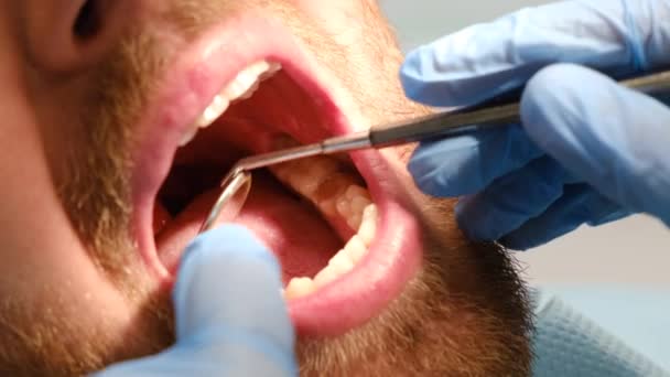 Paziente Bocca Aperta Seduto Sulla Sedia Dei Dentisti Medico Esamina — Video Stock