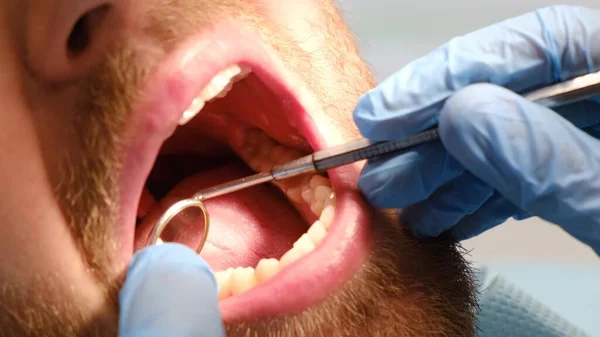 张嘴坐在牙医椅子上的病人 医生检查口腔 近距离检查 口腔卫生 牙科学 — 图库照片