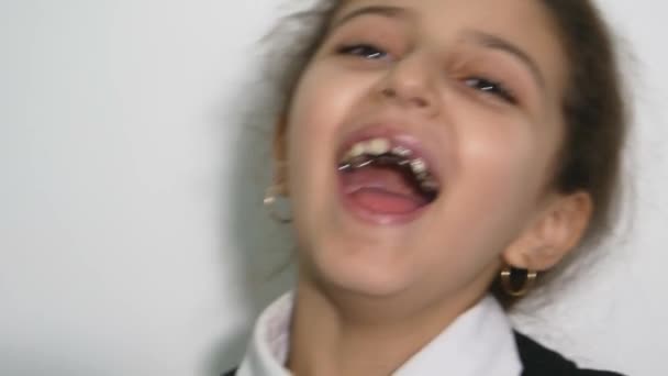 Preschool Girl Open Mouth Baby Tooth American Little Girl — Stock Video