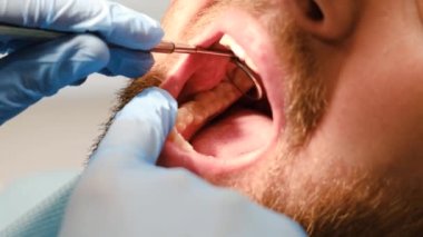 Close up of oral cavity during dental treatment. Examination with a dental mirror. Close up of the oral cavity