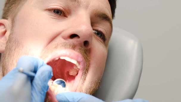 Close Young Patients Oral Treatment Dental Treatment Examination Dental Mirror — Vídeo de stock
