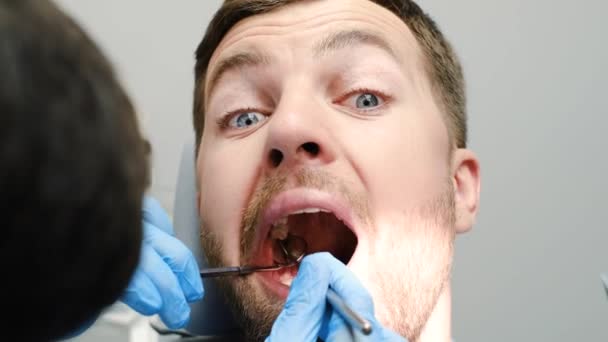 Крупный План Испуганного Молодого Пациента Стоматологическом Кресле Время Лечения Зубов — стоковое видео