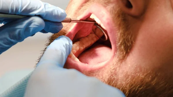 Close Oral Cavity Dental Treatment Examination Dental Mirror Close Oral — 图库照片