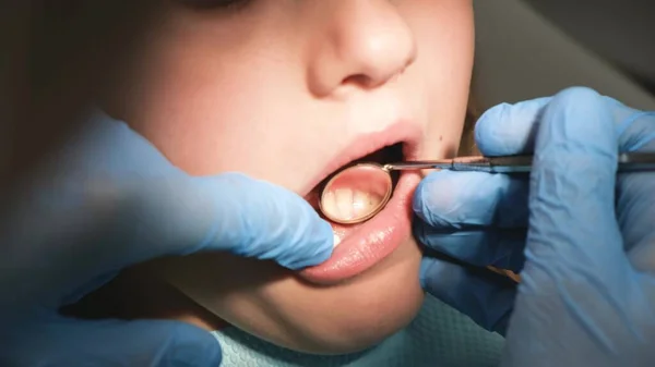一名男牙医用牙镜检查一名少女的口腔 儿童的牙科治疗 — 图库照片