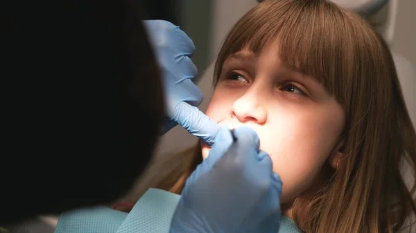 一名男牙医用牙镜检查一名少女的口腔 儿童的牙科治疗 — 图库照片