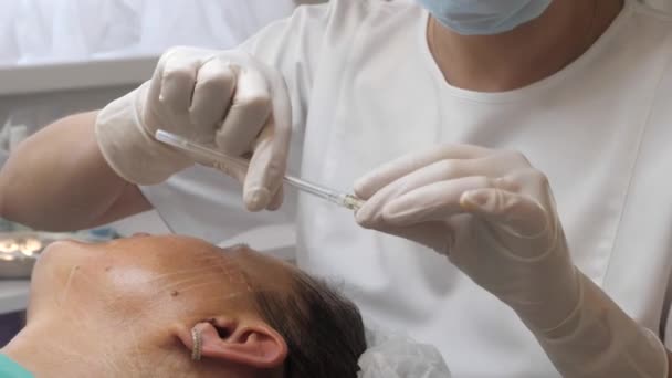 Kirurgen utför en ansiktslyftning operation — Stockvideo