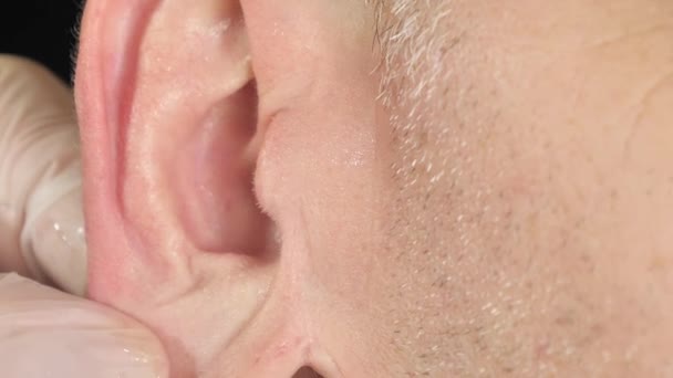 A clean ear after doing the ear rinsing procedure — Stock Video
