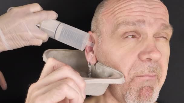 Процедура промивання вуха на лівому вусі — стокове відео