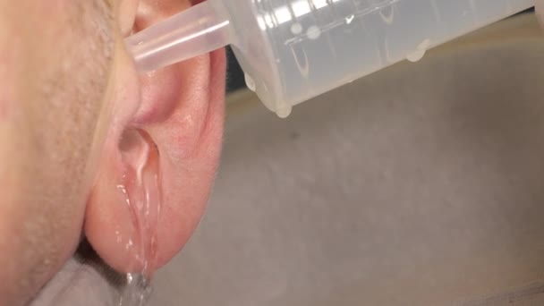 Tekutý propláchnutí vnitřní straně ucha muže — Stock video