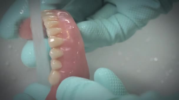 Foto penutup gigi palsu yang dibersihkan di bawah air yang mengalir. — Stok Video