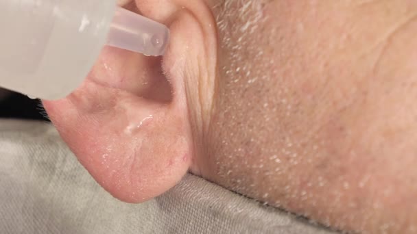 Closer Look Left Ear Man While Ear Rinsing Procedure — Stockvideo