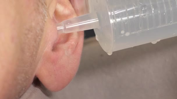 Closer Look Ear Rinsing Procedure Man Using Syringe Liquid — 비디오