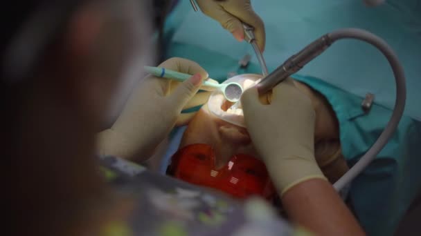 Mulher dentista trata uma mulher. Ela usa um microscópio para examinar o dente com mais precisão e confiança — Vídeo de Stock