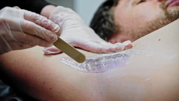 The epilation master applies purple wax on the male armpit using a spatula — Video Stock
