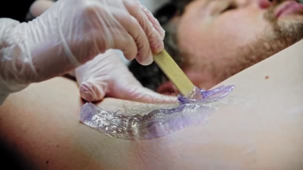 Epileringsmästaren applicerar lila vax på den manliga armhålan med hjälp av en träspatel — Stockvideo