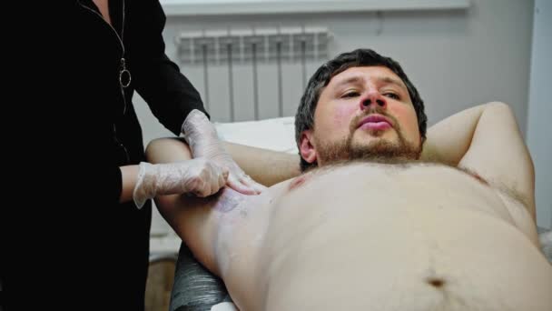 The epilation master tears the wax off the mans armpit — Video Stock