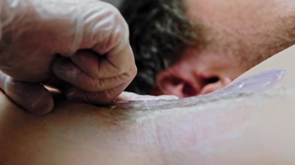 Epileringsmästaren sliter av vaxet på armhålan på sin manliga klient. — Stockvideo