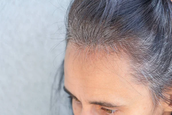 Κοντινό πλάνο της μέσης ηλικίας καυκάσιας γυναίκας με σκούρα καστανά μαλλιά και αναγεννημένες γκρίζες ρίζες τρίχες — Φωτογραφία Αρχείου