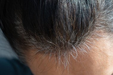 Orta yaşlı, beyaz, koyu kahverengi saçlı ve yeniden uzamış saçları olan bir kadın.