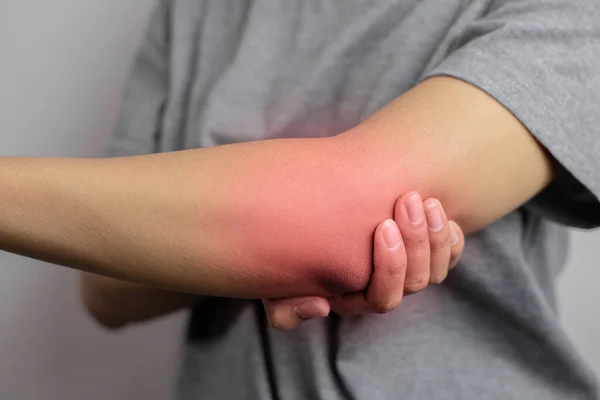 Women with pain in elbow. Acute pain in a elbow. Young woman holds on to elbow.