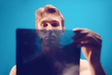 Hasta ofisteki röntgen ve MRI 'ı inceliyor.