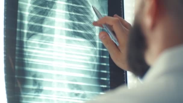 Dokter Onderzoekt Röntgenfoto Mri Het Kantoor Begrip Geneeskunde Gezondheidszorg — Stockvideo