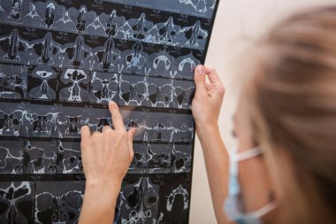  Siyah üniformalı, uzun sarı saçlı beyaz bir kadın doktorun elinde MR taraması var.