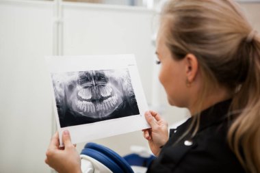 Siyah üniformalı, uzun sarı saçlı dişçi kadın elinde çenesinin röntgenini tutuyor.