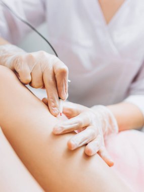 Dermatolog, elektroliz ile hastaların bacakları için tüy dökücü tedavi uyguluyor. Epilasyon ve güzellik kavramı, elektro-epilasyon yapan eller. Kozmetik tıp dolabında çalışan bir doktor..
