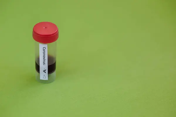 Átlátszó Üvegből Készült Injekciós Üveg Címkékkel Covid Teszttel Íróasztalon Lévő — Stock Fotó