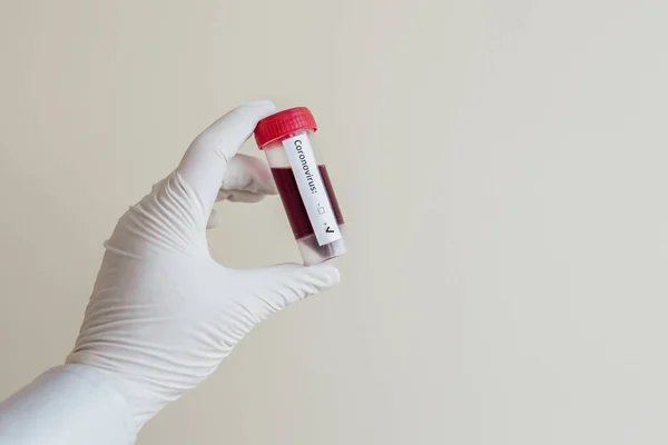 Frascos Para Injetáveis Vidro Transparente Com Rótulos Com Uma Vacina — Fotografia de Stock