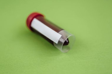 Klinikteki bir hemşire bir erkek için kan testi yapmak için damarına sonda yerleştiriyor. Mavi tıbbi eldiven. Kapat..