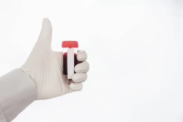 Uma Enfermeira Clínica Insere Cateter Numa Veia Para Análise Sangue — Fotografia de Stock