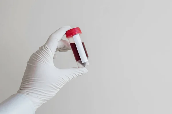 Uma Enfermeira Clínica Insere Cateter Numa Veia Para Análise Sangue — Fotografia de Stock