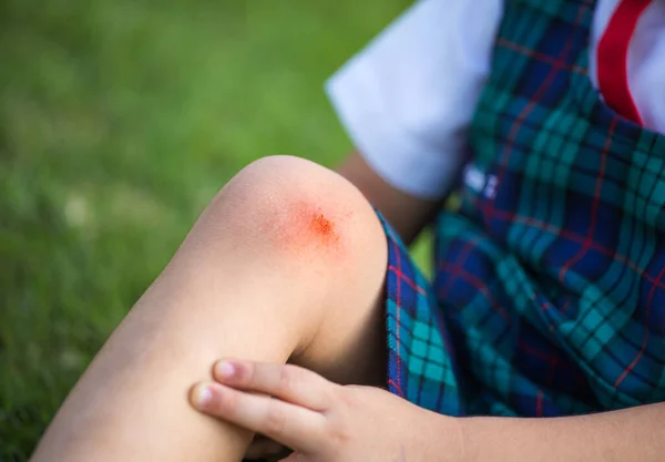 Close up on an bleeding scraped kid\'s knee. Children injury - painful knee wound accident.