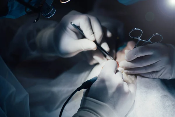 Arbeit Eines Chirurgen Operationssaal Ein Chirurgisches Instrument Der Hand — Stockfoto