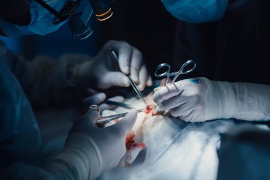 Ameliyathanede cerrahların takım çalışması, eldiven takmak, ameliyat aletleriyle yakın çekim yapmak.