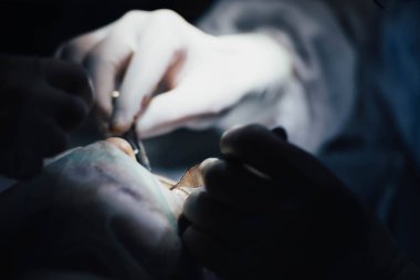 Ameliyathanede cerrahların takım çalışması, eldiven takmak, ameliyat aletleriyle yakın çekim yapmak.