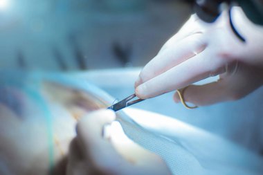 surgeon operates on the patient in the operating room, close-up hands hold scissors clamps for surgical sutures.