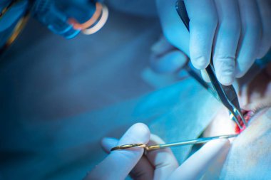 surgeon operates on the patient in the operating room, close-up hands hold scissors clamps for surgical sutures.