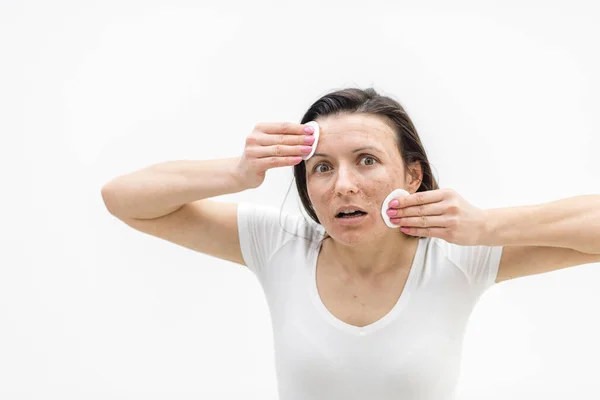 Fotografie ženy čistící obličej s kosmetickými houbami. — Stock fotografie