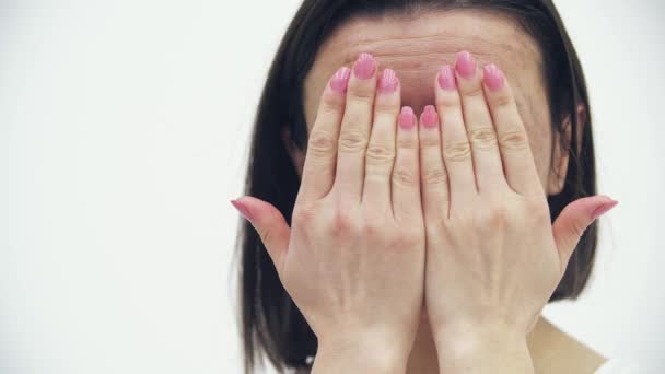 4k close-up video van vrouw met huidproblemen en het verbergen van haar gezicht. — Stockvideo