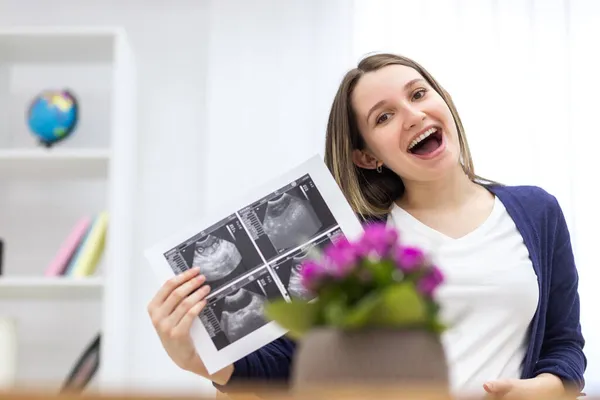Foto einer lächelnden Schwangeren mit Ultraschallbild. — Stockfoto