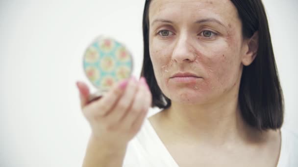 4k slow motion video of close up female face with dry skin looking in the mirror. — Stok Video