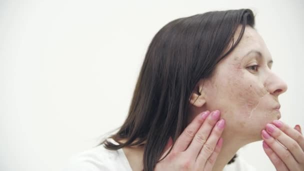 4k vídeo de la mujer con acné problema apretando espinilla en el interior. — Vídeos de Stock