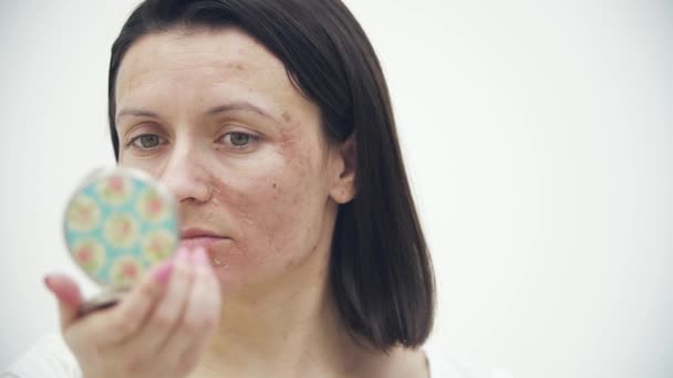 4k повільне відео руху крупним планом жіноче обличчя з сухою шкірою, що дивиться у дзеркало . — стокове відео