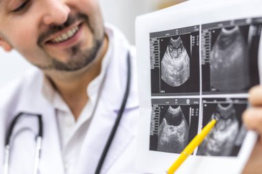 Ultrason sonuçlarına bakan bir erkek doktorun kesilmiş fotoğrafı..